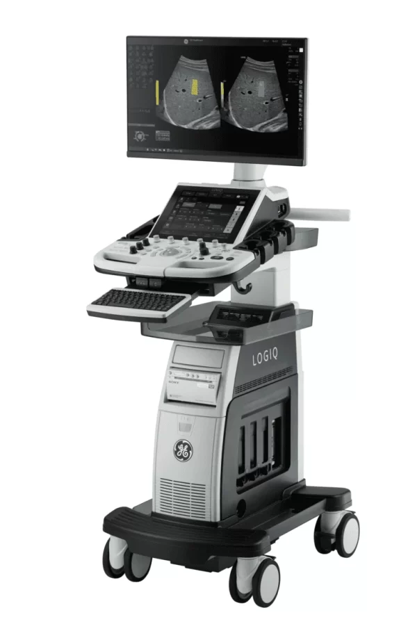 GE LOGIQ P10