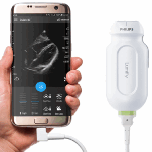 Philips Lumify (hand-held)