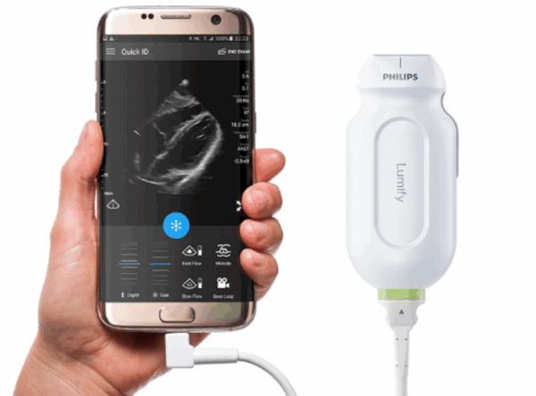 Philips Lumify (hand-held)