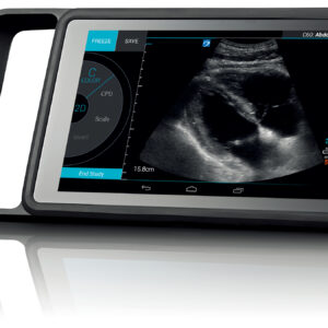 SonoSite iViz