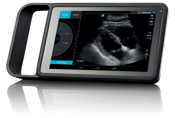 SonoSite iViz