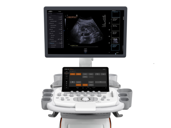 Ultrassom ACUSON Sequoia
