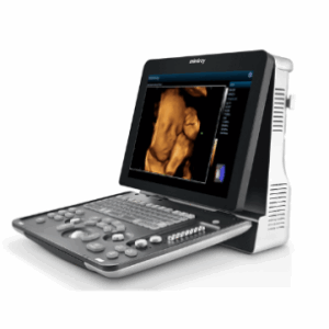 Mindray Z60